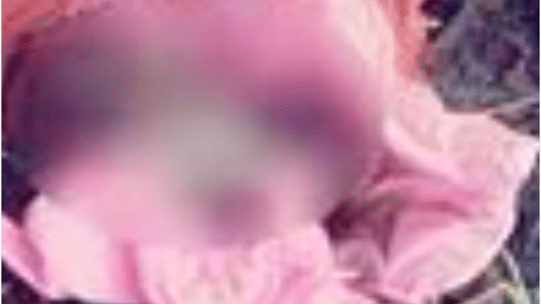 सीवरेज की सफाई के दौरान मिला इंसानी भ्रूण