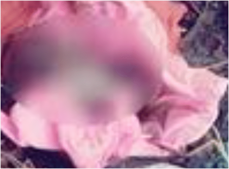 सीवरेज की सफाई के दौरान मिला इंसानी भ्रूण